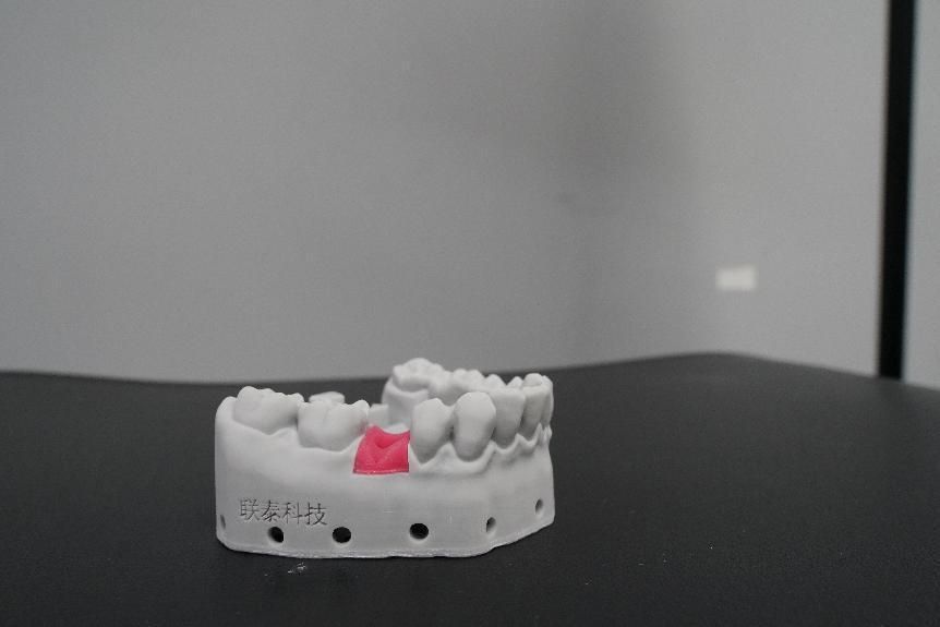 欧美强奸网站在线观看 3D打印在牙科的应用