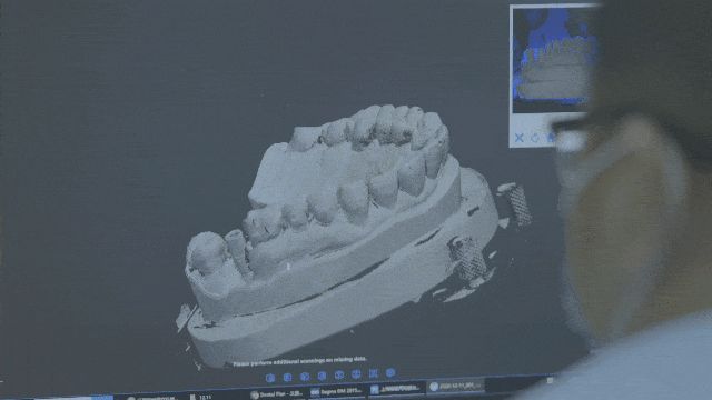 欧美强奸网站在线观看 3D打印在牙科的应用