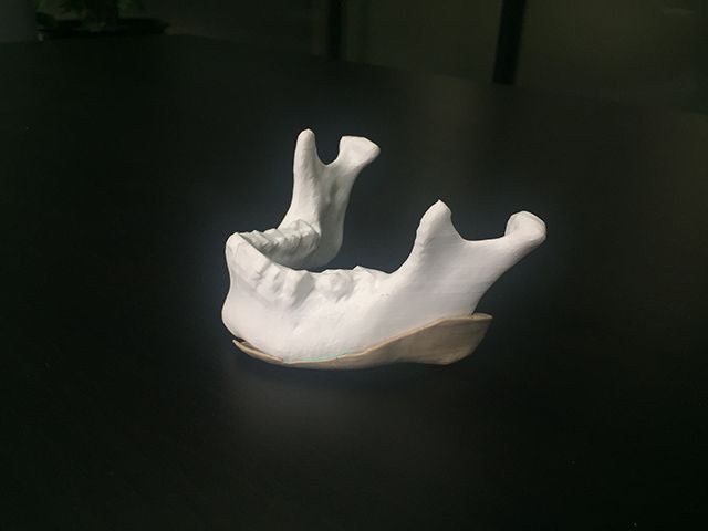 欧美日韩舔阴3p在线 技术指南 | 3D打印技术之FDM熔融沉积成型技术