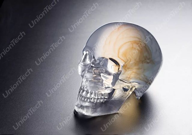 欧美日韩在线观看视频 联泰答疑室 | 3D打印，我劝你在医疗行业别这么“嚣张”