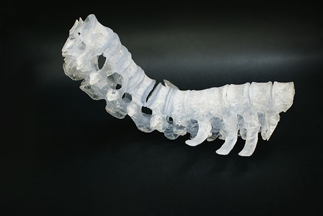 欧美日韩在线观看视频 联泰答疑室 | 3D打印，我劝你在医疗行业别这么“嚣张”