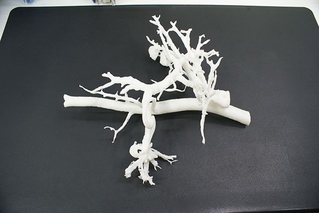 欧美日韩在线观看视频 联泰答疑室 | 3D打印，我劝你在医疗行业别这么“嚣张”