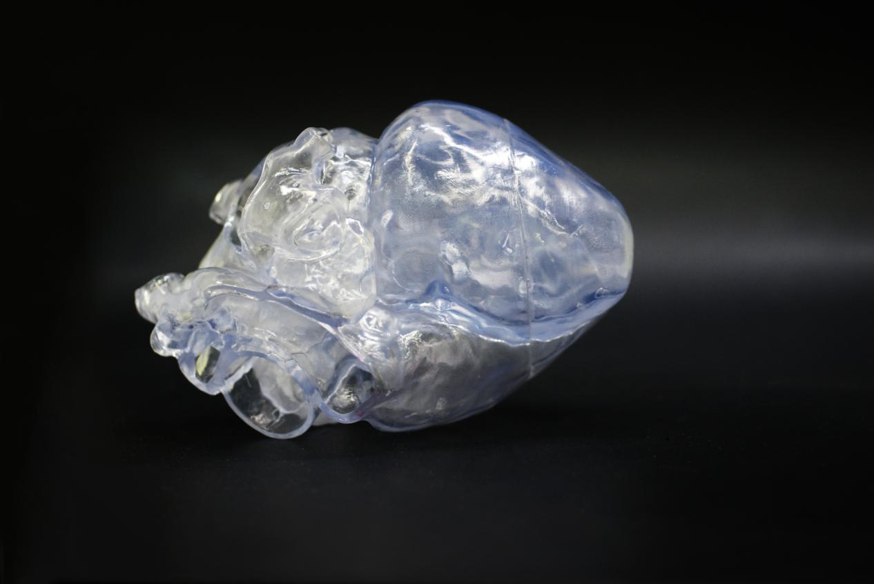 欧美强奸网站在线观看 增材制造3d打印在医疗领域的应用